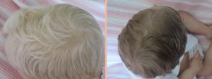Reborn Baby Rooted Hair | Micro Rooting